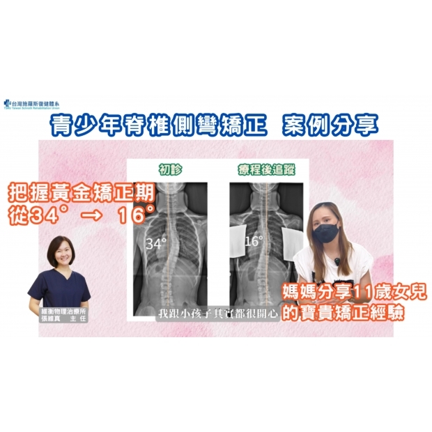 11歲女孩側彎矯正案例分享 34°→16°-封面.jpg